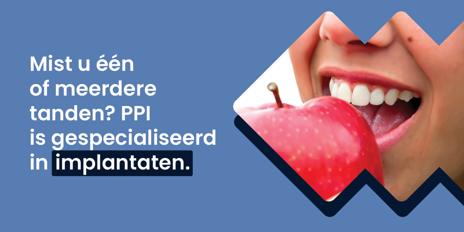 Mist u één of meerdere tanden? PPI Hoorn is gespecialiseerd in implantaten. Mist u één of meerdere tanden? PPI Hoorn is gespecialiseerd in implantaten.