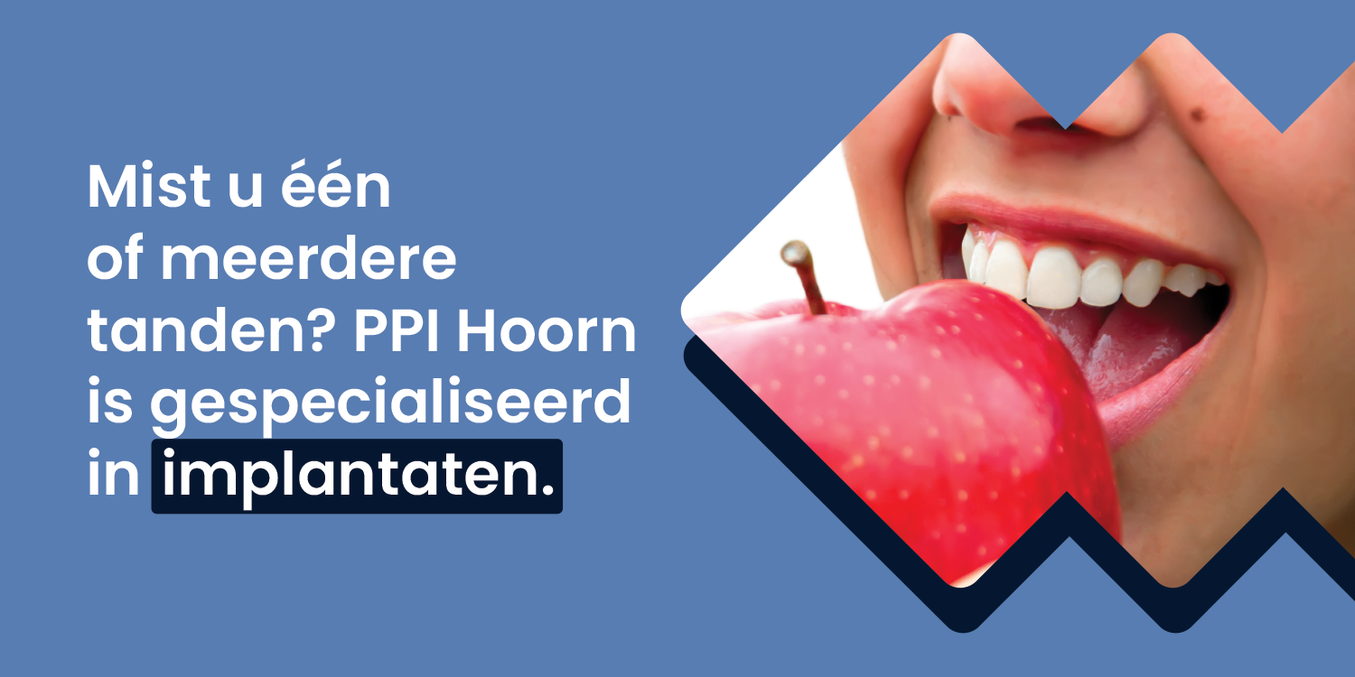 Mist u één of meerdere tanden? PPI Hoorn is gespecialiseerd in implantaten. Mist u één of meerdere tanden? PPI Hoorn is gespecialiseerd in implantaten.